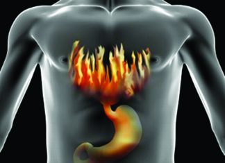 Γαστροοισοφαγική παλινδρόμηση: γιατί δεν πρέπει να αγνοούμε τα συμπτώματα