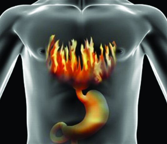 Γαστροοισοφαγική παλινδρόμηση: γιατί δεν πρέπει να αγνοούμε τα συμπτώματα